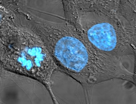 Раковые клетки HeLa. Ядро (особенно ДНК) подсвечено голубым цветом. 