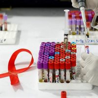 Учёным удалось вылечить второго пациента с ВИЧ