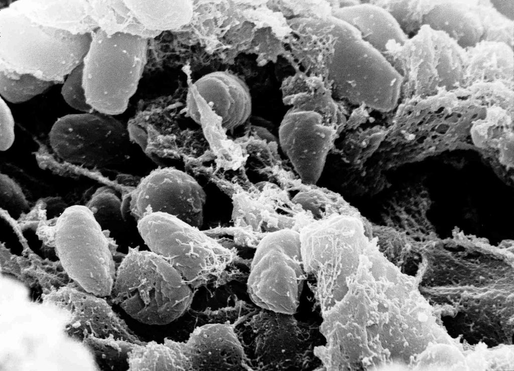 Бактерия Yersinia pestis