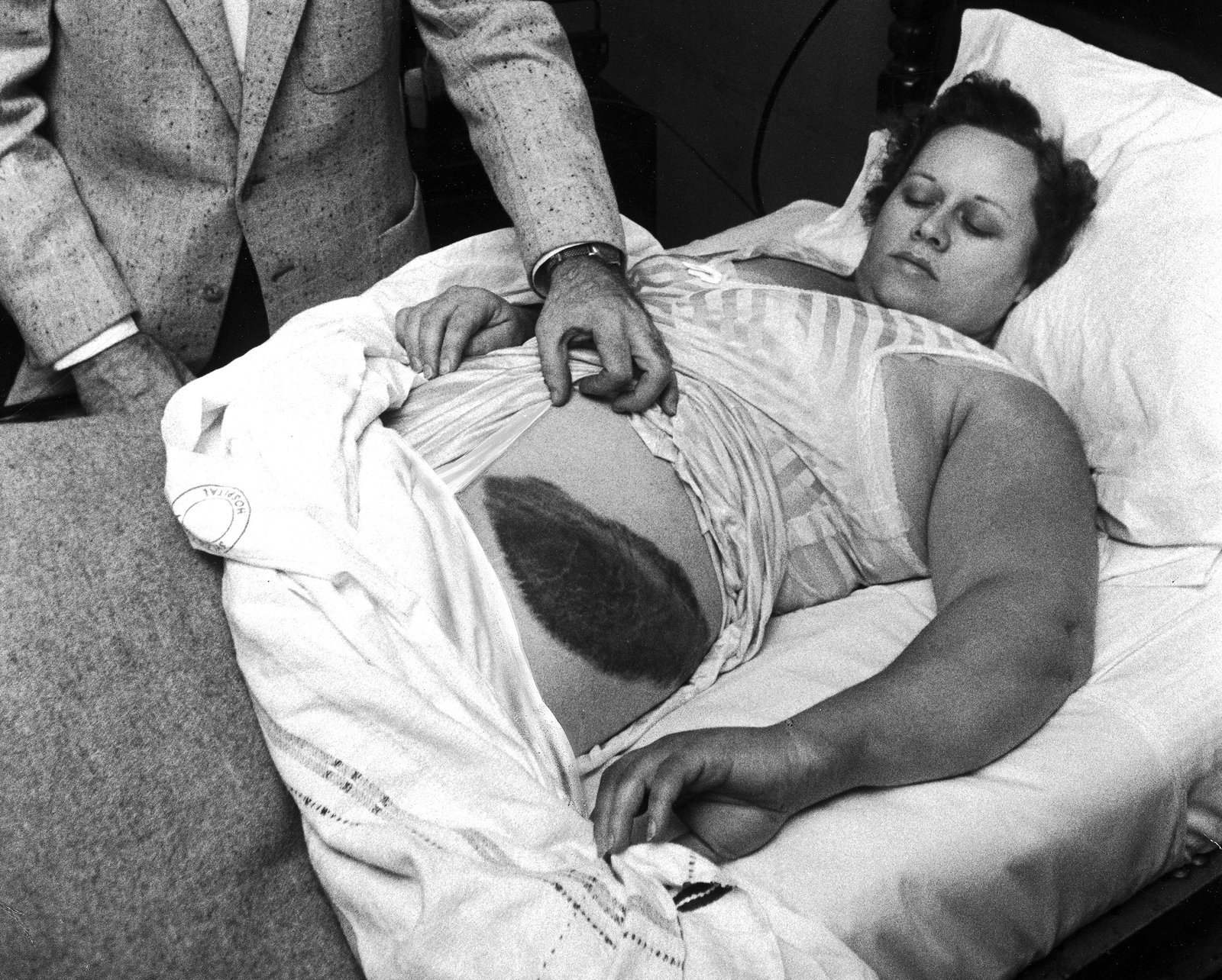 История Энн Ходжес – первой задокументированной жертвы падения метеорита