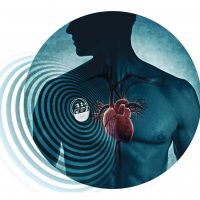 Cysoni: учёные разработали «бионический» кардиостимулятор