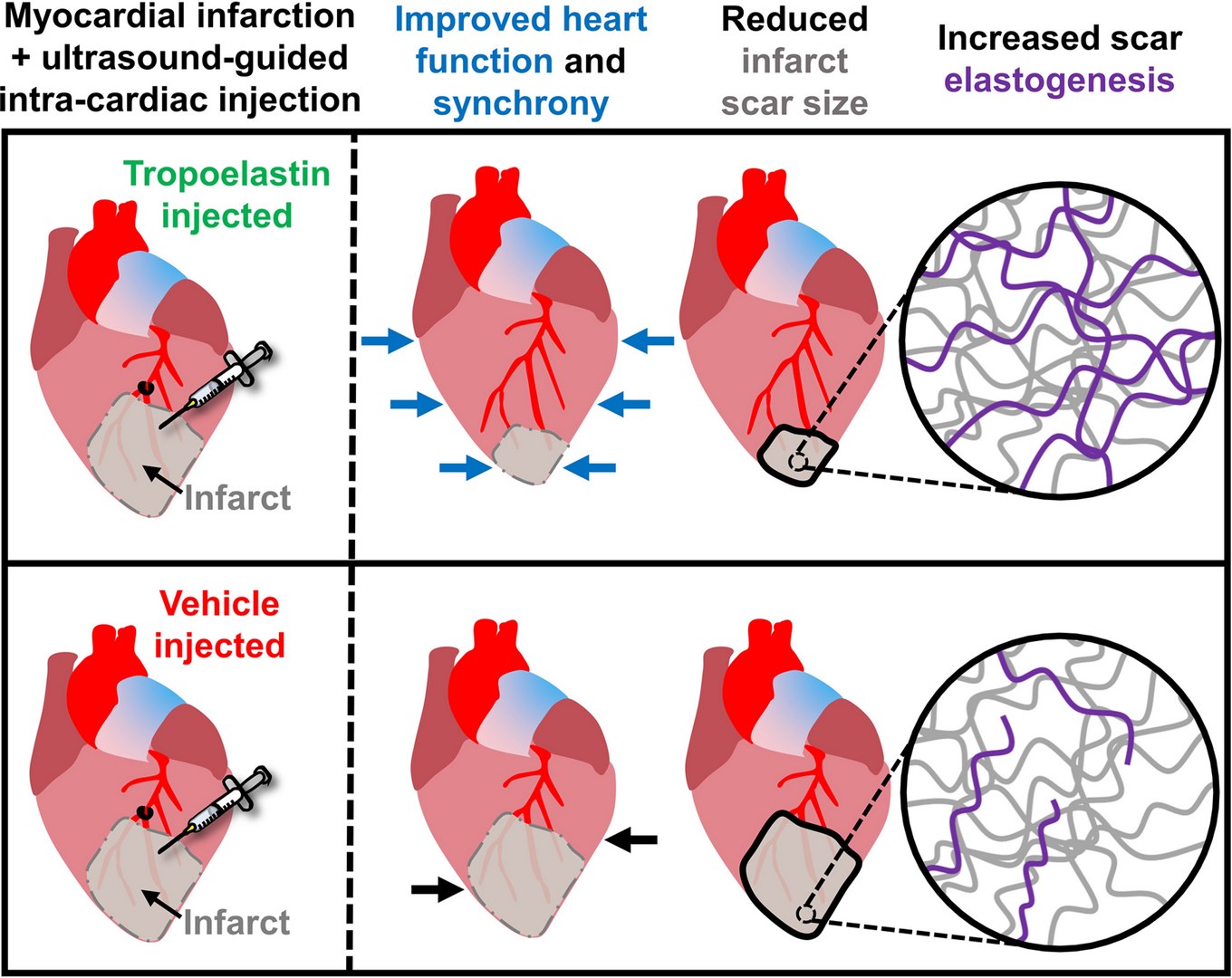 Инъекции тропоэластина заживляют рубцы после инфаркта