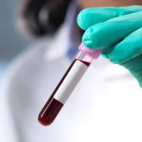 Анализы крови могут выявить болезнь Крона до «кишечных» симптомов